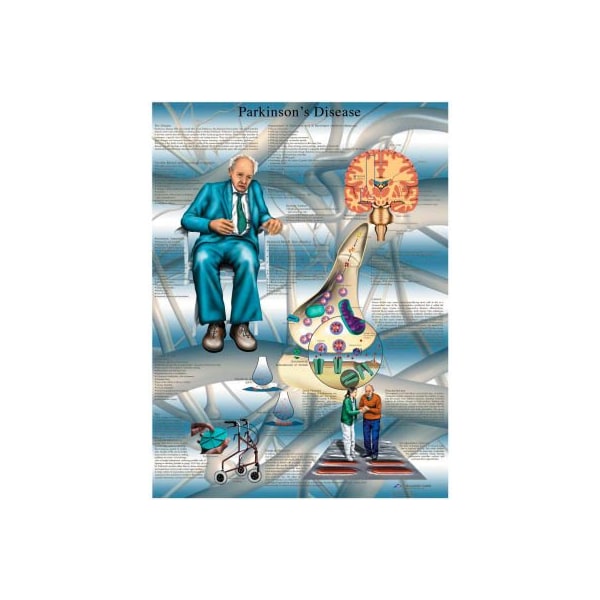 3B Anatomical Chart - Parkinson's Disease, Laminated